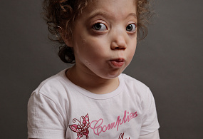 Rare, but not unknown anymore